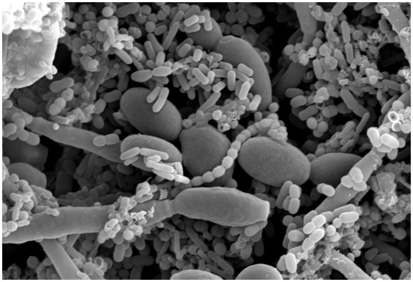 Electron Microscope Image of microbiome sample